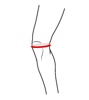 Obvod kolene - McDavid ortéza